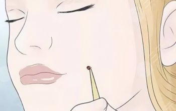 色素痣恶变的警示